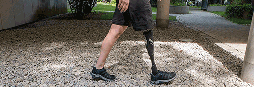 پروتزهای زیبایی